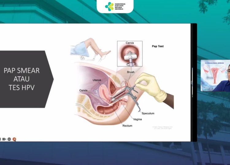 Ilustrasi pap smear.